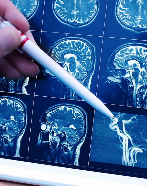 QN neuropsychiatry services landing page